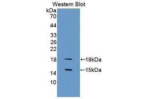 Western blot analysis of the recombinant protein. (GDF3 antibody  (AA 253-366))