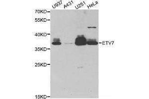 Western Blotting (WB) image for anti-Ets Variant 7 (ETV7) antibody (ABIN1882381)
