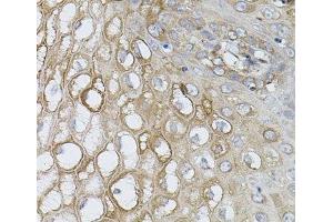 Immunohistochemistry of paraffin-embedded Human esophagus using UBE2A Polyclonal Antibody (UBE2A antibody)