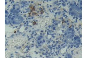 Used in DAB staining on fromalin fixed paraffin- embedded testis tissue (TNFRSF13C antibody  (AA 45-169))