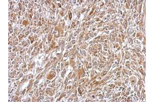 IHC-P Image Immunohistochemical analysis of paraffin-embedded C2C12 xenograft, using Plasminogen, antibody at 1:500 dilution. (PLG antibody)