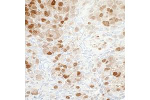 Immunohistochemistry (IHC) image for anti-Nicotinamide phosphoribosyltransferase (NAMPT) (AA 400-450) antibody (ABIN7454014) (Recombinant NAMPT antibody  (AA 400-450))