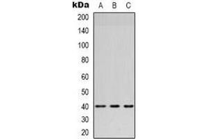 Western blot analysis of HSD3B7 expression in Lovo (A), MCF7 (B), Hela (C) whole cell lysates. (HSD3B7 antibody)