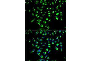 Immunofluorescence analysis of MCF-7 cell using CD86 antibody. (CD86 antibody)