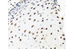 Immunohistochemistry of paraffin-embedded Human esophagus using PRPF8 Polyclonal Antibody at dilution of 1:100 (40x lens). (PRPF8 antibody)