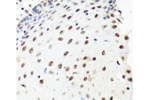 Immunohistochemistry of paraffin-embedded Human esophagus using PRPF8 Polyclonal Antibody at dilution of 1:100 (40x lens).