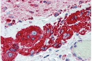 Human Small Intestine, Myenteric Plexus: Formalin-Fixed, Paraffin-Embedded (FFPE) (TUBB2A antibody  (AA 1-446))