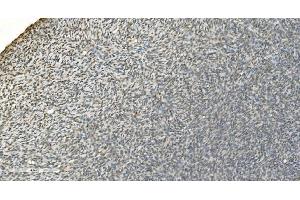 IHC analysis of LSM7 using anti-LSM7 antibody (ABIN7598937). (LSM7 antibody  (AA 1-103))