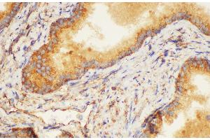 Immunohistochemistry of paraffin-embedded Human prostate using K1KB3 Ployclonal Antibody at dilution of 1:200. (KLK1B3 antibody)