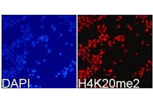 Immunofluorescence analysis of 293T cell using H4K20me2 antibody. (Histone 3 antibody  (2meLys20))