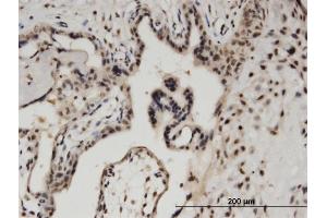 Immunoperoxidase of monoclonal antibody to BCL11A on formalin-fixed paraffin-embedded human placenta. (BCL11A antibody  (AA 1-88))