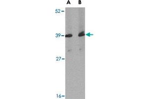 Western blot analysis of Apba1 in mouse spleen tissue lysate with Apba1 polyclonal antibody  at (A) 1 and (B) 2 ug/mL . (APBA1 antibody  (Internal Region))