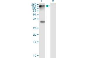 Western Blot analysis of EPHB1 expression in transfected 293T cell line by EPHB1 monoclonal antibody (M01), clone 4G6.