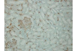 Immunohistochemistry (IHC) image for anti-Complement Component C4d (C4d) (Internal Region) antibody (ABIN870587) (Complement C4d antibody  (Internal Region))