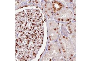 Immunohistochemical staining (Formalin-fixed paraffin-embedded sections) of human kidney with FUS monoclonal antibody, clone CL0190  shows strong nuclear positivity in both renal glomeruli and tubuli. (FUS antibody)
