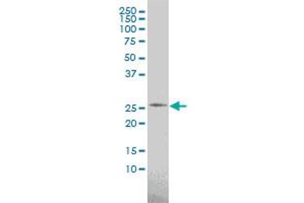 PSPH antibody  (AA 1-225)