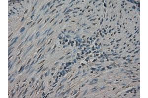 Immunohistochemical staining of paraffin-embedded Ovary tissue using anti-NEK6mouse monoclonal antibody. (NEK6 antibody)