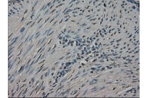Immunohistochemical staining of paraffin-embedded Ovary tissue using anti-NEK6mouse monoclonal antibody. (NEK6 antibody)