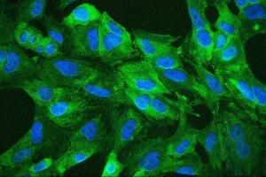 IF analysis of ALDH1A1 using anti-ALDH1A1 antibody (ABIN7602127).
