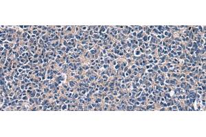 Immunohistochemistry of paraffin-embedded Human tonsil tissue using LAMP3 Polyclonal Antibody at dilution of 1:30(x200) (LAMP3 antibody)