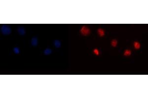 IF analysis of YY1 using anti-YY1 antibody (ABIN6719534). (YY1 antibody  (Middle Region))