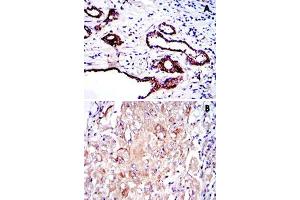 Immunohistochemical analysis of paraffin-embedded human prostate tissue (A) and lung cancer tissue (B) using PKN2 monoclonal antobody, clone 1D1  with DAB staining.