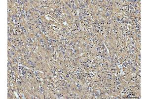 IHC analysis of COL6A1 using anti-COL6A1 antibody (ABIN7600515).
