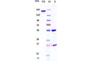 Anti-Mesothelin Reference Antibody (BMS-986148) on SDS-PAGE under reducing (R) condition.