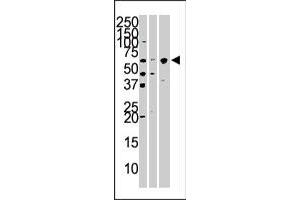 The KPNA4 polyclonal antibody  is used in Western blot to detect KPNA4 in Hela (left) , mouse brain (middle) , and HepG2 (right) cell and tissue lysates. (KPNA4 antibody  (N-Term))