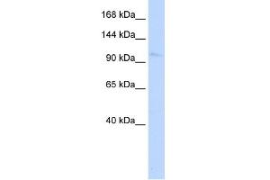 WB Suggested Anti-NKX1-1 Antibody Titration:  0. (NKX1-1 antibody  (Middle Region))