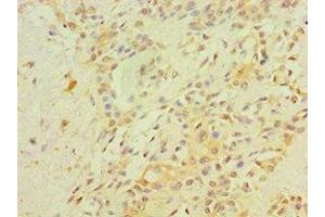 Immunohistochemistry (IHC) image for anti-Retinoblastoma 1 (RB1) (AA 649-928) antibody (ABIN7167784)