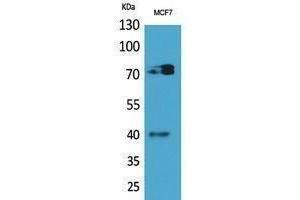Western Blotting (WB) image for anti-Myeloproliferative Leukemia Virus Oncogene (MPL) (Internal Region) antibody (ABIN3178485)