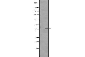 Western blot analysis of SNAPC3 expression in A431 whole cell lysate ,The lane on the left is treated with the antigen-specific peptide. (SNAPC3 antibody  (C-Term))