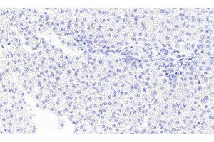ABIN5872058 Negative Control showing staining of paraffin embedded Human Liver, with no primary antibody.