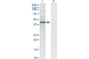 Western Blot analysis of SEC63 expression in transfected 293T cell line by SEC63 monoclonal antibody (M04), clone 1A8.