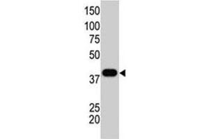The SUMO1 polyclonal antibody  is used in Western blot to detect GST-SUMO1 fusion protein. (SUMO1 antibody  (C-Term))