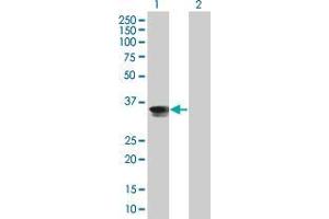 Lane 1: CENPH transfected lysate ( 28. (CENPH 293T Cell Transient Overexpression Lysate(Denatured))