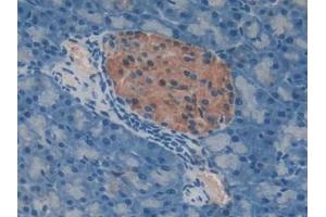 DAB staining on IHC-P; Samples: Mouse Pancreas Tissue (TIMP3 antibody  (AA 20-211))