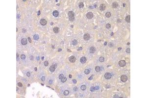 Immunohistochemistry of paraffin-embedded Mouse liver using FGFR1 Polyclonal Antibody at dilution of 1:100 (40x lens). (FGFR1 antibody)