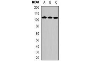 Western blot analysis of DPD expression in Hela (A), HepG2 (B), Jurkat (C) whole cell lysates. (DPYD antibody)