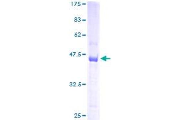 TSC22D1 Protein (AA 1-144) (GST tag)