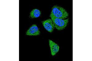 Confocal immunofluorescent analysis of C6 Antibody (N-term) (ABIN390924 and ABIN2841126) with MDA-M cell followed by Alexa Fluor® 488-conjugated goat anti-rabbit lgG (green).