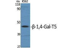 Western Blot (WB) analysis of specific cells using beta-1,4-Gal-T5 Polyclonal Antibody. (B4GALT5 antibody  (C-Term))