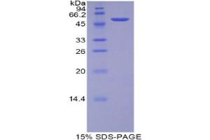SDS-PAGE analysis of Rat TFAM Protein. (TFAM Protein)
