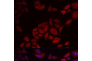 Immunofluorescence analysis of U2OS cells using PIKFYVE Polyclonal Antibody