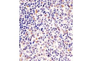 (ABIN6243124 and ABIN6578087) staining DPYSL5 in human tonsil sections by Immunohistochemistry (IHC-P - paraformaldehyde-fixed, paraffin-embedded sections). (DPYSL5 antibody  (C-Term))