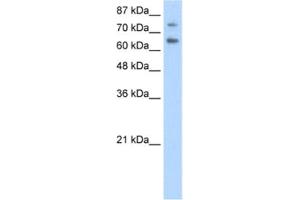 Western Blotting (WB) image for anti-Zinc Finger and SCAN Domain Containing 2 (ZSCAN2) antibody (ABIN2462016) (ZSCAN2 antibody)