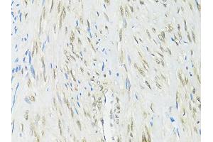 Immunohistochemistry of paraffin-embedded human uterus using RBFOX3 antibody (ABIN1874561) at dilution of 1:100 (40x lens). (NeuN antibody)