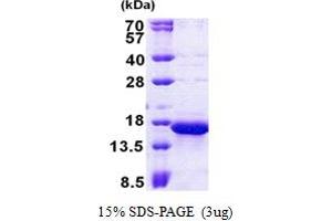 SDS-PAGE (SDS) image for Mitochondrial Import Receptor Subunit TOM20 homolog (TOMM20) (AA 25-145) protein (His tag) (ABIN5852987)