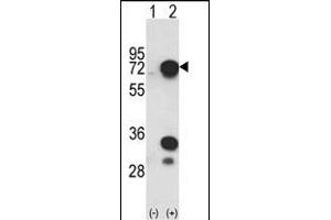 Western blot analysis of HNRPL (arrow) using rabbit polyclonal HNRPL Antibody (C-term) (ABIN650773 and ABIN2839553).